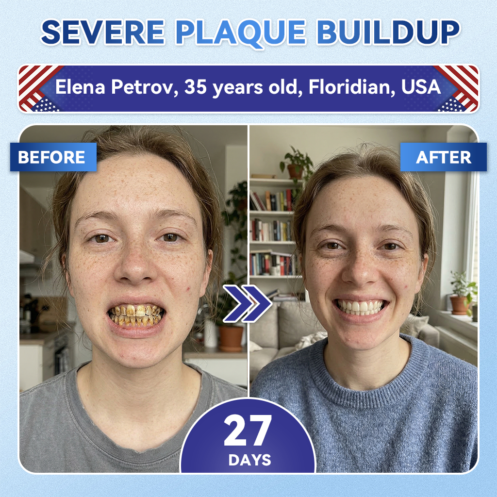QIAWI® 🦷 Tideglusib Fast‑Dissolving Tooth & Gum Repair Oral Strips 😁 (Supports tooth repair and helps relieve gum discomfort and other common oral concerns)