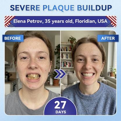 QIAWI® 🦷 Tideglusib Fast‑Dissolving Tooth & Gum Repair Oral Strips 😁 (Supports tooth repair and helps relieve gum discomfort and other common oral concerns)