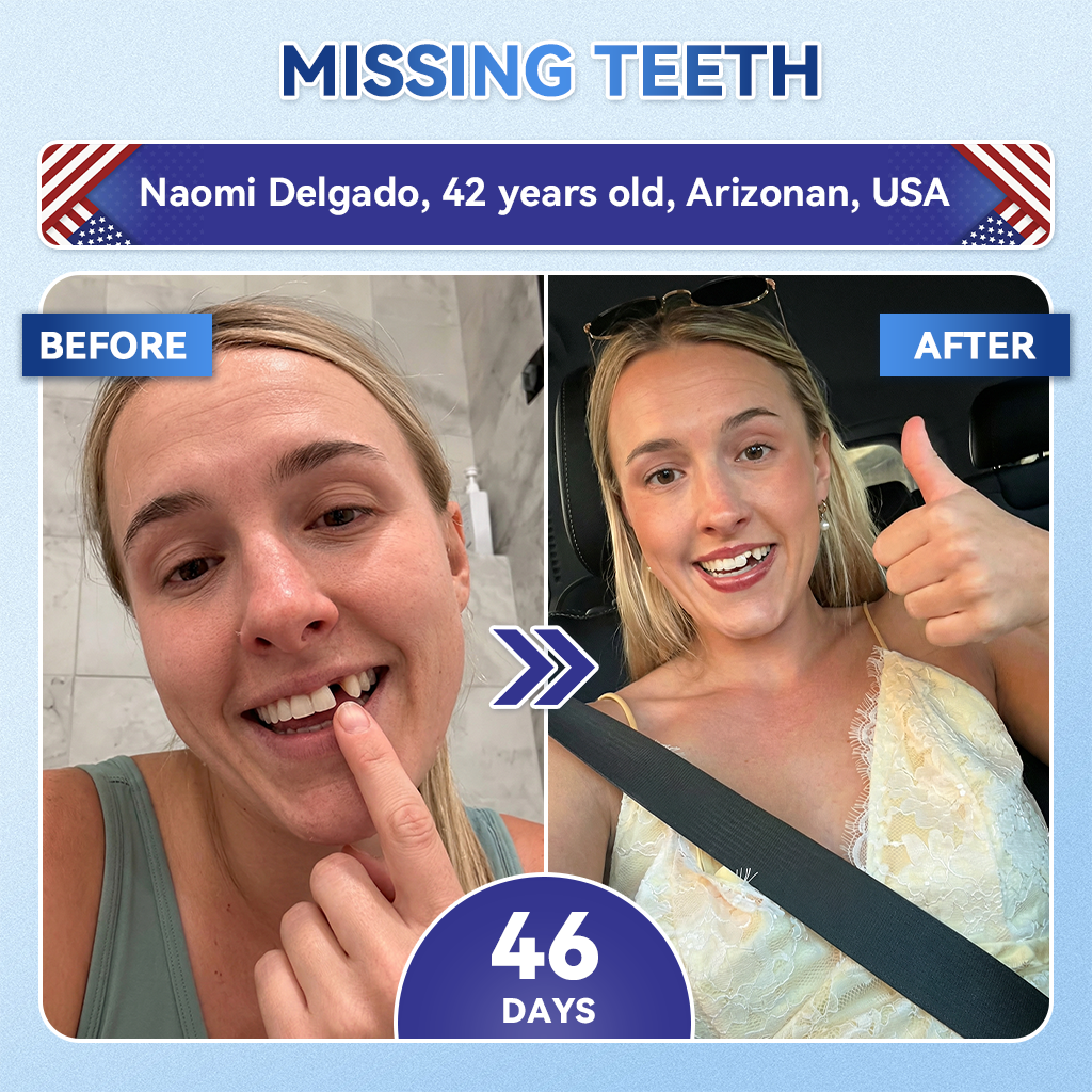 QIAWI® 🦷 Tideglusib Fast‑Dissolving Tooth & Gum Repair Oral Strips 😁 (Supports tooth repair and helps relieve gum discomfort and other common oral concerns)
