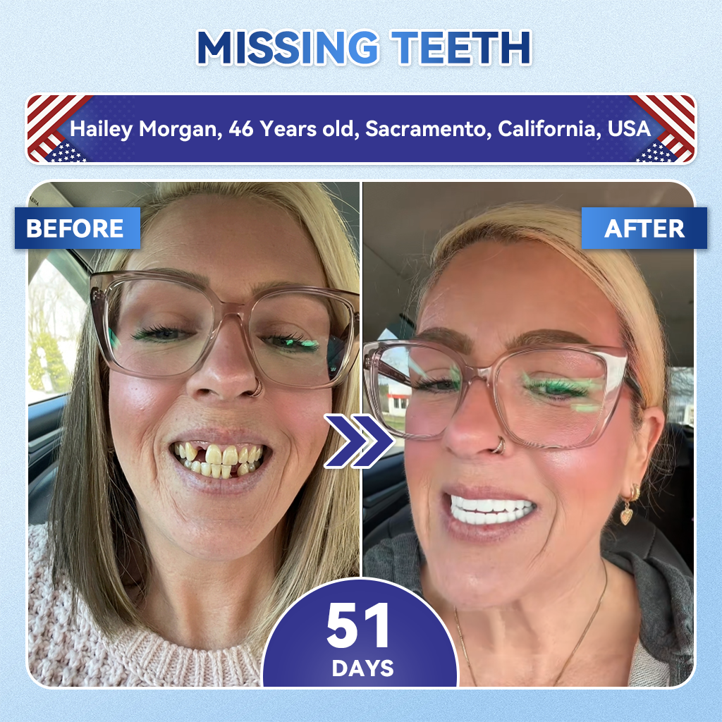 QIAWI® 🦷 Tideglusib Fast‑Dissolving Tooth & Gum Repair Oral Strips 😁 (Supports tooth repair and helps relieve gum discomfort and other common oral concerns)