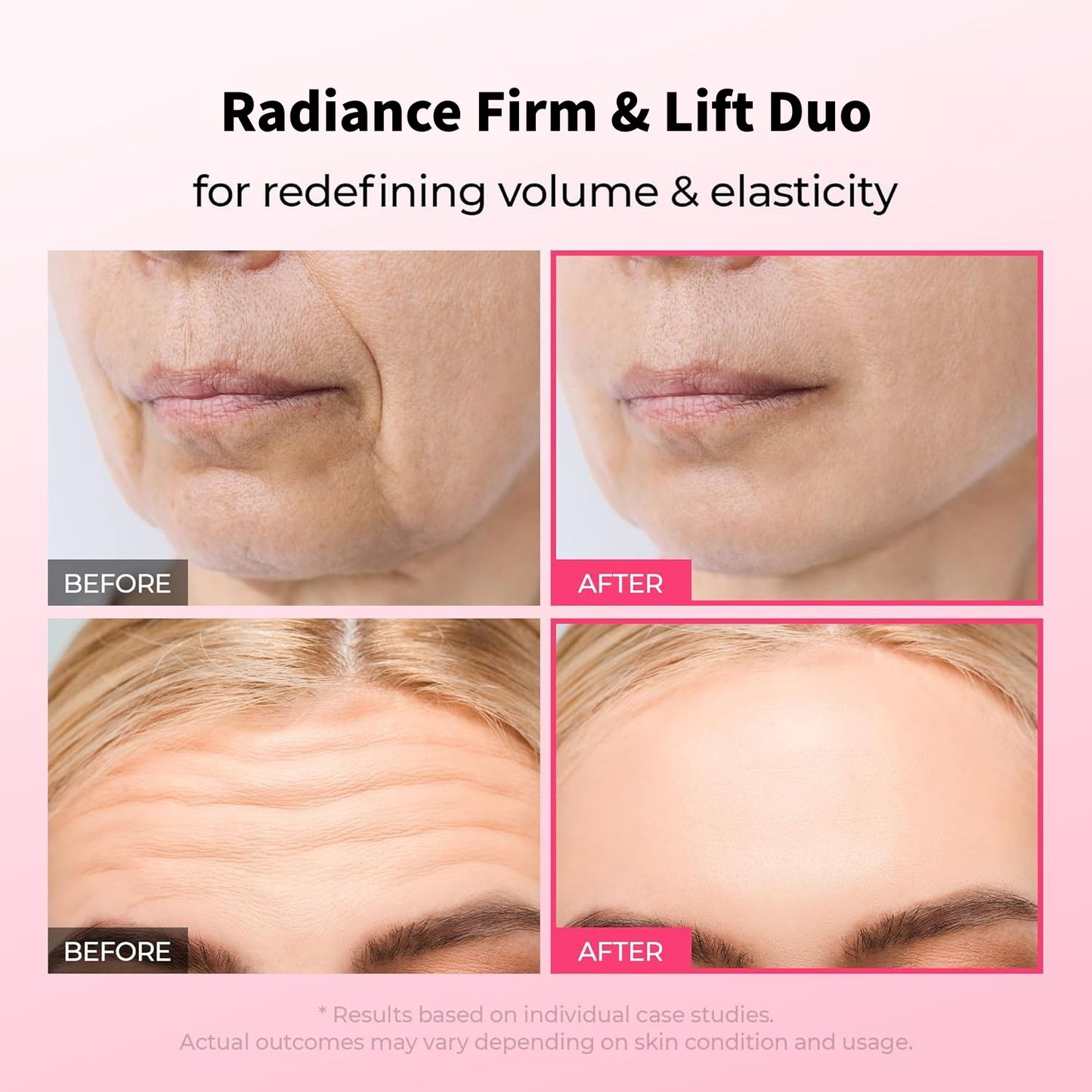 🔥Christmas Special Offer🔥Gifted Collagen Boost five Step Set Calcium Collagen Balm for Firming & Pore Care